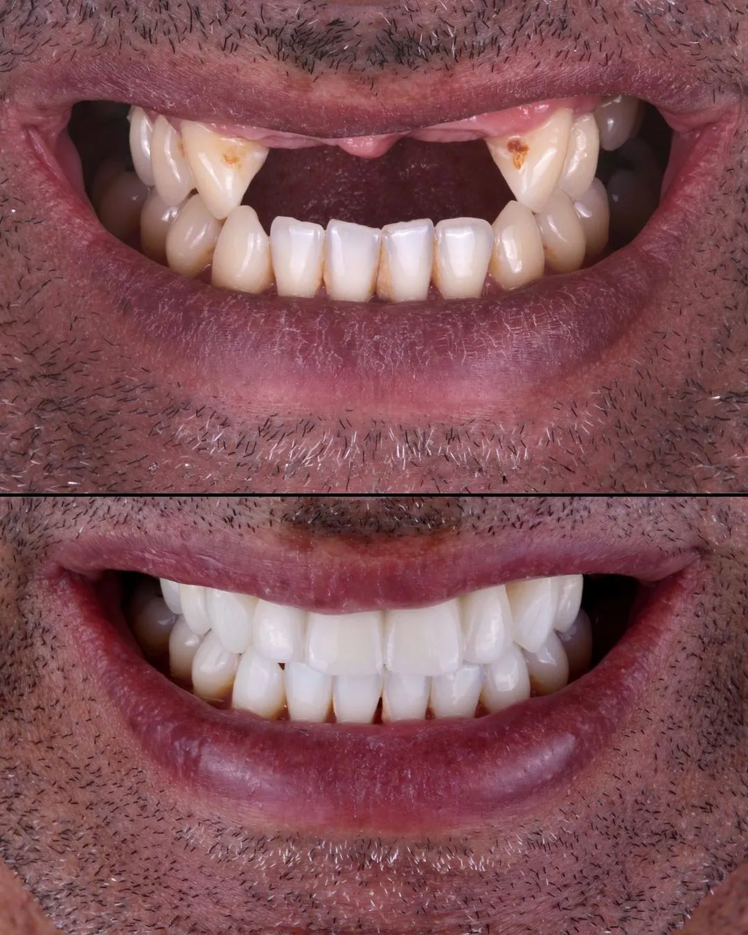 Before after dental images