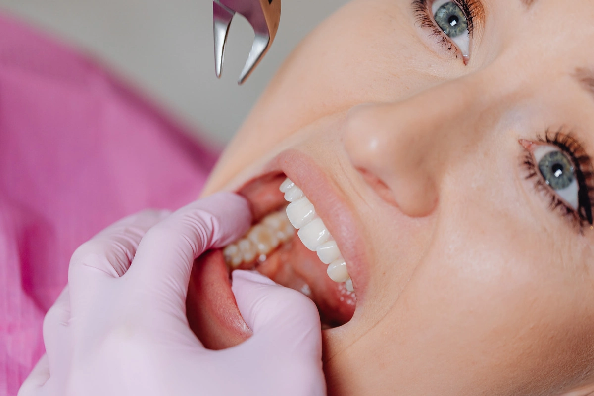 In Which Situations Should a Tooth Not Be Extracted?