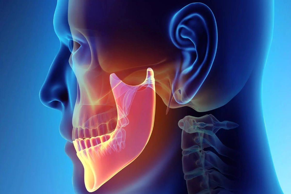 Temporomandibular Joint (TMJ) Treatment